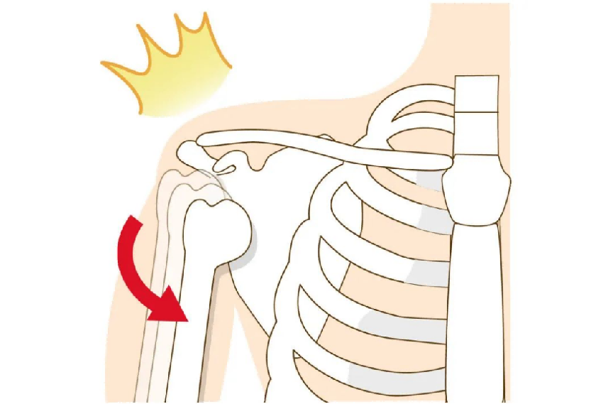 深圳医生两小时“驯服”法国奶爸多年旧伤354